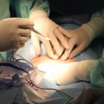 Aus Angst vor den Schmerzen bevorzugen immer mehr Frauen einen Wunschkaiserschnitt.