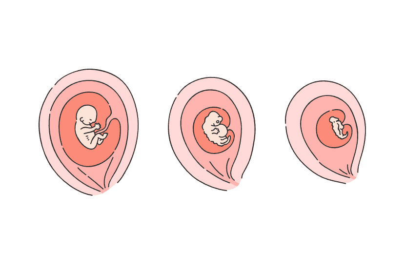 Die Entwicklung des Embryos im ersten Trimester der Schwangerschaft