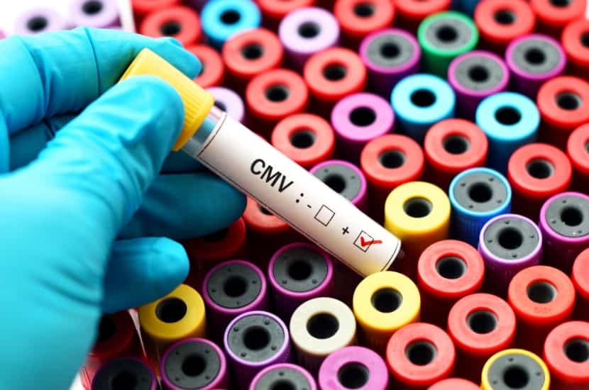 Zytomegalievirus-Infektion (CMV-Infektion) in der Schwangerschaft